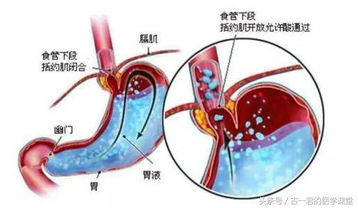 食管最新分段标准2017，食管疾病诊断与治疗的新里程碑